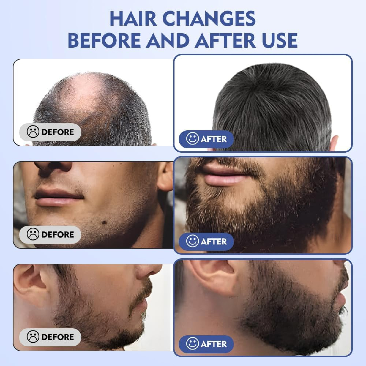 قلم میکرونیدلینگ درماپن برای جوان سازی پوست و رشد مو